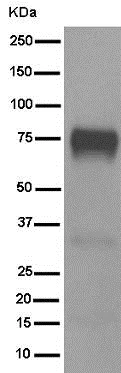 Western blot - Anti-5T4 antibody [EPR5530] - BSA and Azide free (AB189508)