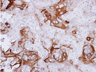 Immunohistochemistry (Formalin/PFA-fixed paraffin-embedded sections) - Anti-67kDa Laminin Receptor antibody (AB137388)