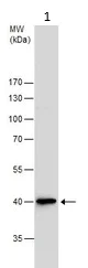 Western blot - Anti-67kDa Laminin Receptor antibody (AB137388)