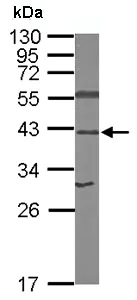 Western blot - Anti-67kDa Laminin Receptor antibody (AB137388)
