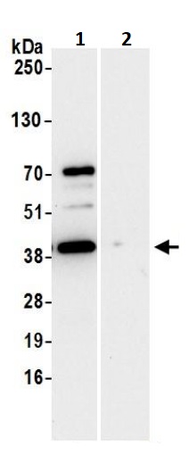 Immunoprecipitation - Anti-67kDa Laminin Receptor antibody (AB245561)