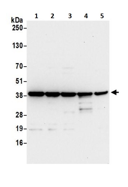 Western blot - Anti-67kDa Laminin Receptor antibody (AB245561)