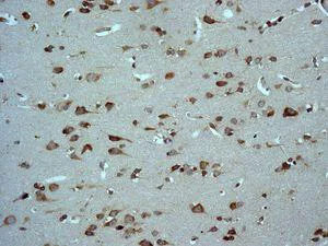 Immunohistochemistry (Formalin/PFA-fixed paraffin-embedded sections) - Anti-67kDa Laminin Receptor antibody [EPR8468] (AB133775)