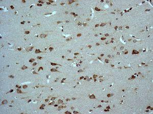 Immunohistochemistry (Formalin/PFA-fixed paraffin-embedded sections) - Anti-67kDa Laminin Receptor antibody [EPR8468] - BSA and Azide free (AB248653), expandable thumbnail