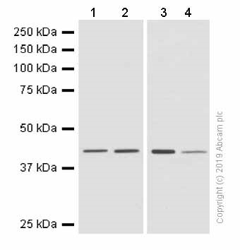 Western blot - Anti-67kDa Laminin Receptor antibody [EPR8468] - BSA and Azide free (AB248653), expandable thumbnail