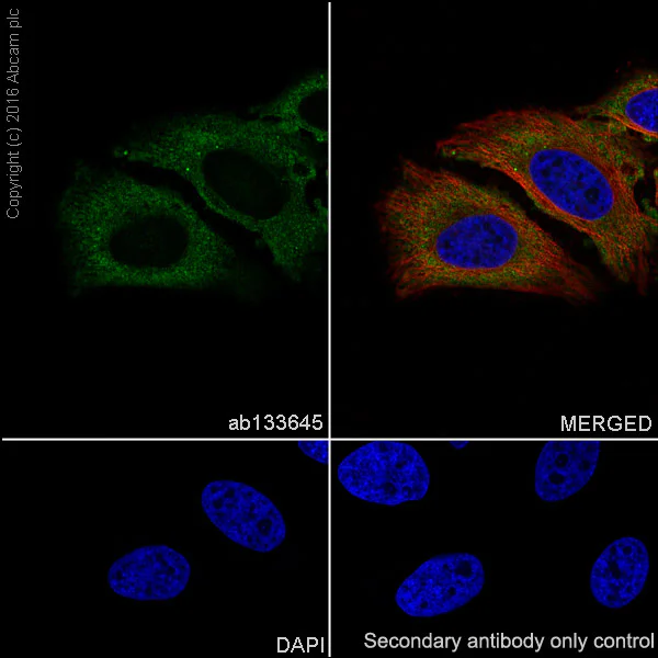Immunocytochemistry/ Immunofluorescence - Anti-67kDa Laminin Receptor antibody [EPR8469] (AB133645)