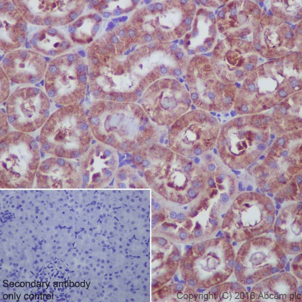 Immunohistochemistry (Formalin/PFA-fixed paraffin-embedded sections) - Anti-67kDa Laminin Receptor antibody [EPR8469] (ab133645), expandable thumbnail