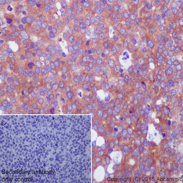 Immunohistochemistry (Formalin/PFA-fixed paraffin-embedded sections) - Anti-67kDa Laminin Receptor antibody [EPR8469] (ab133645), expandable thumbnail