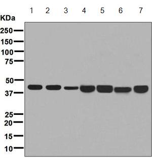 Western blot - Anti-67kDa Laminin Receptor antibody [EPR8469] (ab133645), expandable thumbnail