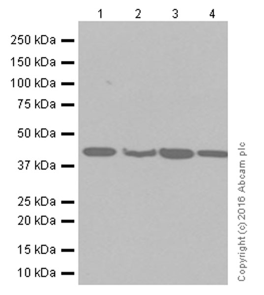 Western blot - Anti-67kDa Laminin Receptor antibody [EPR8469] (ab133645), expandable thumbnail