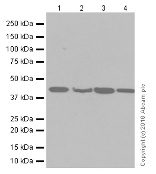 Western blot - Anti-67kDa Laminin Receptor antibody [EPR8469] (AB133645)