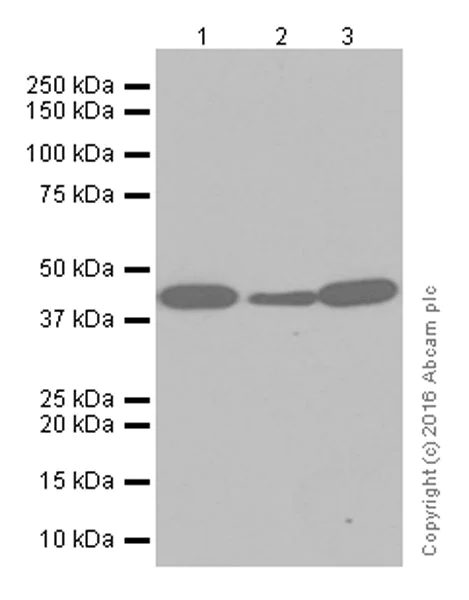 Anti-67kDa Laminin Receptor antibody [EPR8469] (ab133645