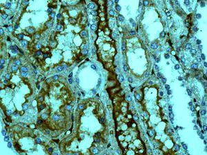 Immunohistochemistry (Formalin/PFA-fixed paraffin-embedded sections) - Anti-67kDa Laminin Receptor antibody [EPR8469] - BSA and Azide free (AB240075)