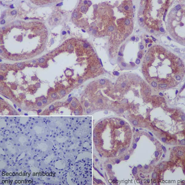 Immunohistochemistry (Formalin/PFA-fixed paraffin-embedded sections) - Anti-67kDa Laminin Receptor antibody [EPR8469] - BSA and Azide free (AB240075)