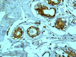 Immunohistochemistry (Formalin/PFA-fixed paraffin-embedded sections) - Anti-67kDa Laminin Receptor antibody [EPR8469] - BSA and Azide free (AB240075)