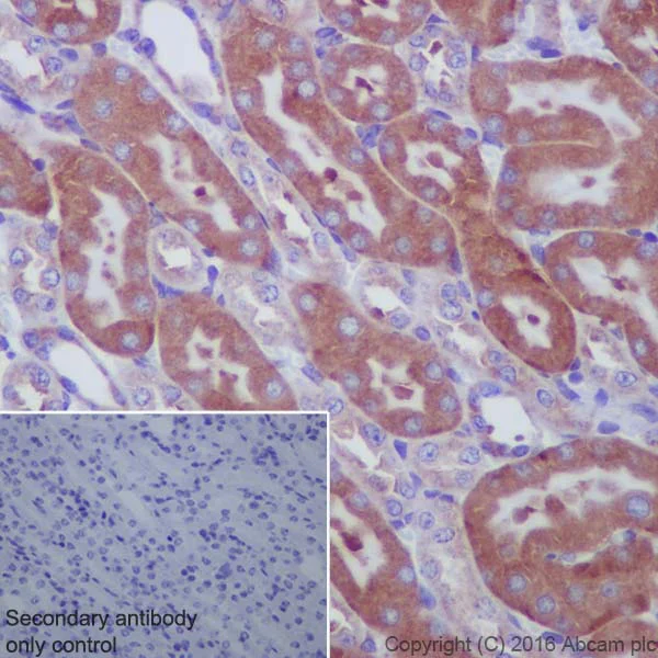 Immunohistochemistry (Formalin/PFA-fixed paraffin-embedded sections) - Anti-67kDa Laminin Receptor antibody [EPR8469] - BSA and Azide free (AB240075)