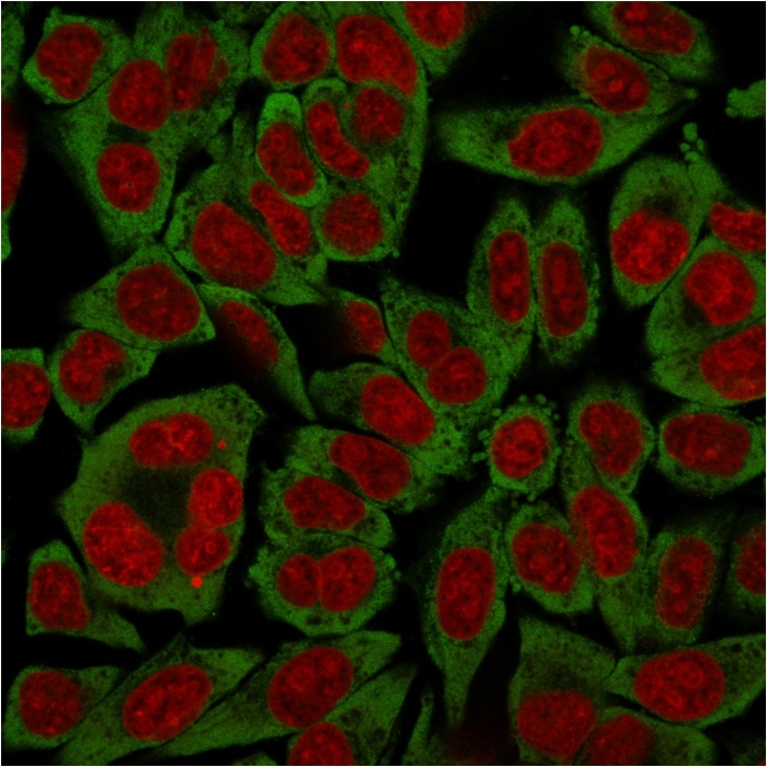Immunocytochemistry/ Immunofluorescence - Anti-67kDa Laminin Receptor antibody [RPSA/2699] (AB268079), expandable thumbnail
