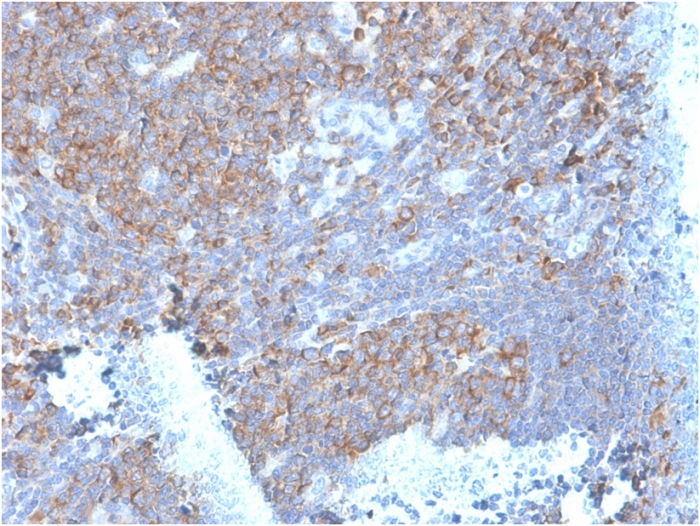 Immunohistochemistry (Formalin/PFA-fixed paraffin-embedded sections) - Anti-67kDa Laminin Receptor antibody [RPSA/2699] (ab268079), expandable thumbnail