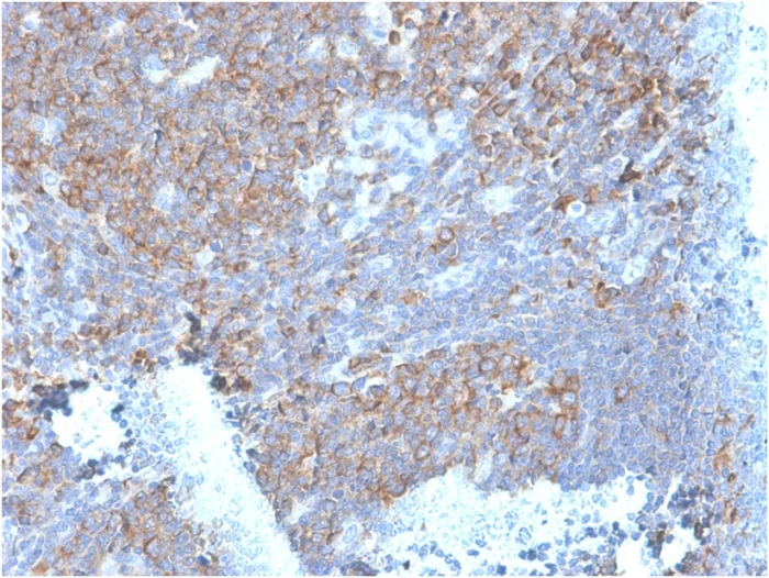 Immunohistochemistry (Formalin/PFA-fixed paraffin-embedded sections) - Anti-67kDa Laminin Receptor antibody [RPSA/2699] (AB268079)