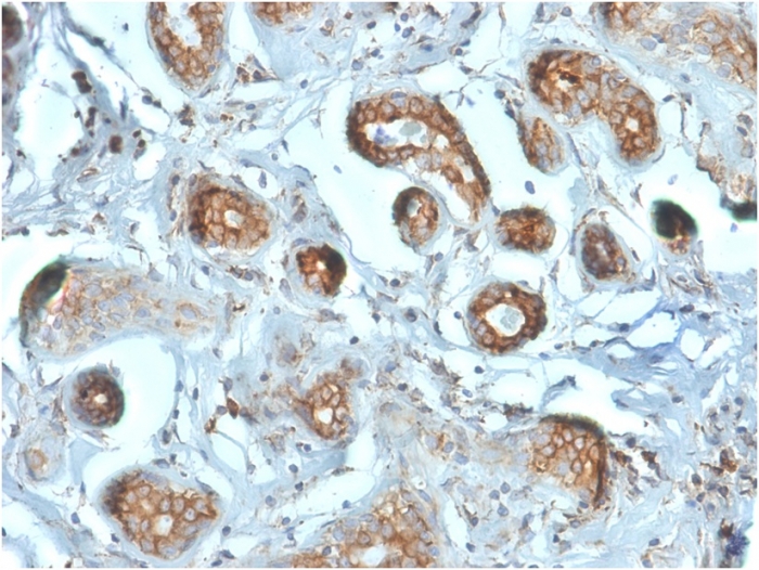 Immunohistochemistry (Formalin/PFA-fixed paraffin-embedded sections) - Anti-67kDa Laminin Receptor antibody [RPSA/2699] (ab268079), expandable thumbnail