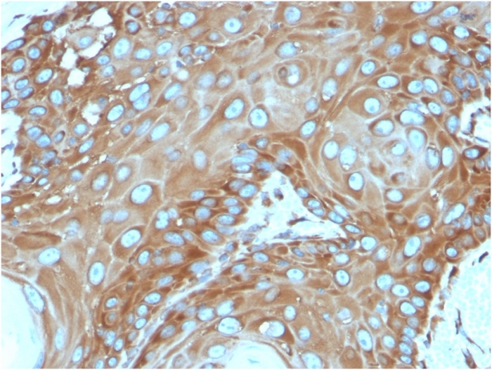 Immunohistochemistry (Formalin/PFA-fixed paraffin-embedded sections) - Anti-67kDa Laminin Receptor antibody [RPSA/2699] (AB268079), expandable thumbnail