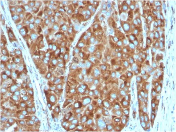 Immunohistochemistry (Formalin/PFA-fixed paraffin-embedded sections) - Anti-67kDa Laminin Receptor antibody [RPSA/2699] (ab268079), expandable thumbnail