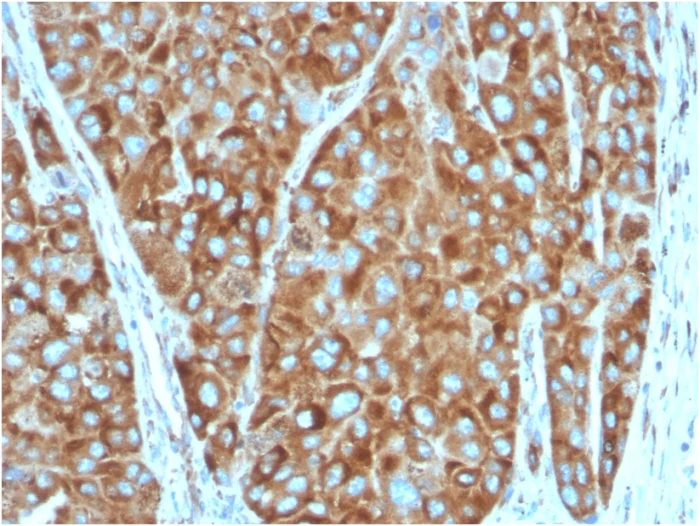 Immunohistochemistry (Formalin/PFA-fixed paraffin-embedded sections) - Anti-67kDa Laminin Receptor antibody [RPSA/2699] (AB268079)