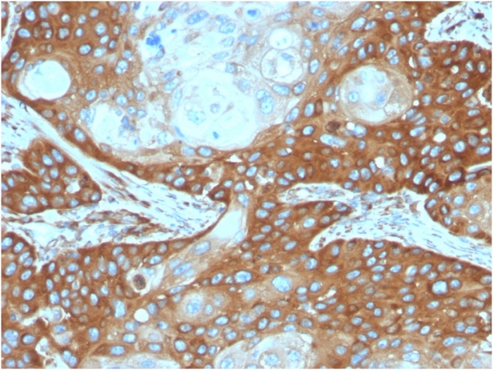 Immunohistochemistry (Formalin/PFA-fixed paraffin-embedded sections) - Anti-67kDa Laminin Receptor antibody [RPSA/2699] (ab268079), expandable thumbnail