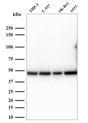 Western blot - Anti-67kDa Laminin Receptor antibody [RPSA/2699] (AB268079), expandable thumbnail