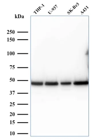 Western blot - Anti-67kDa Laminin Receptor antibody [RPSA/2699] (AB268079)