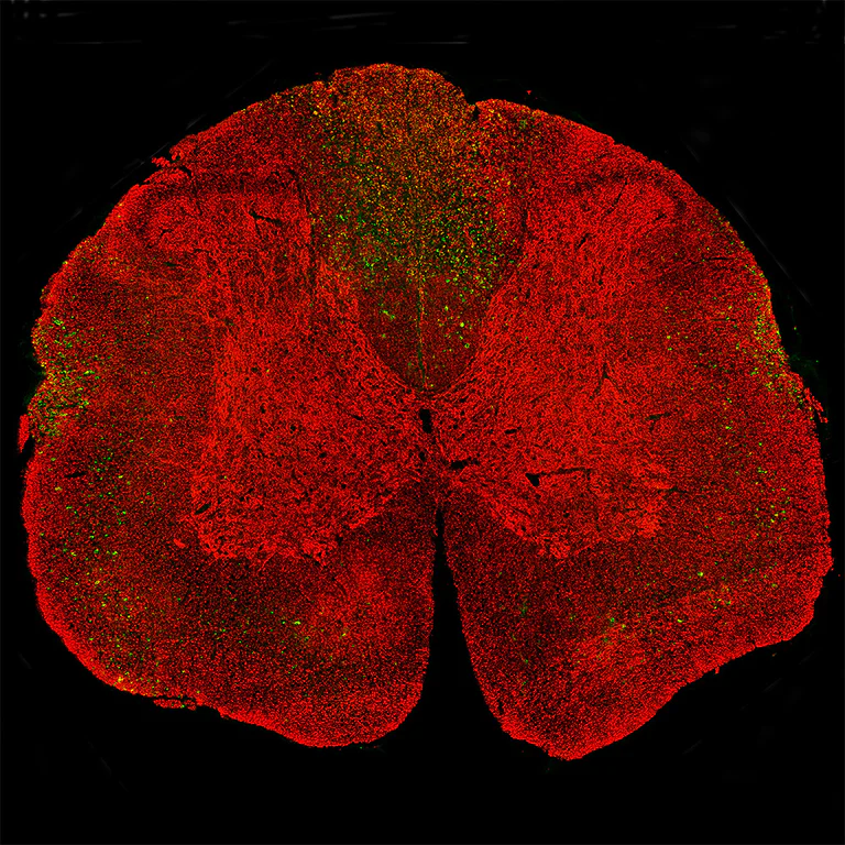 Immunohistochemistry (PFA perfusion fixed frozen sections) - Anti-68kDa Neurofilament/NF-L antibody [1B11] (AB315188)