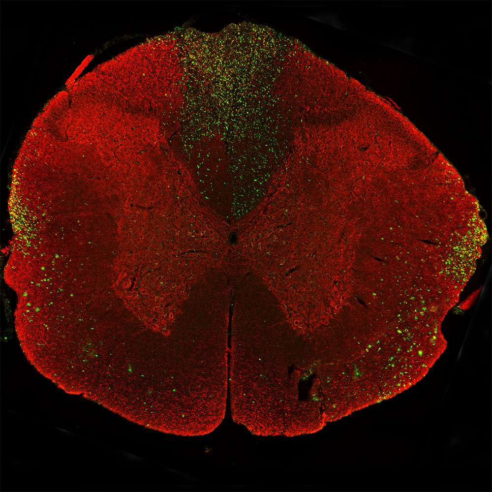 Immunohistochemistry (PFA perfusion fixed frozen sections) - Anti-68kDa Neurofilament/NF-L antibody [6H63] (AB315187), expandable thumbnail