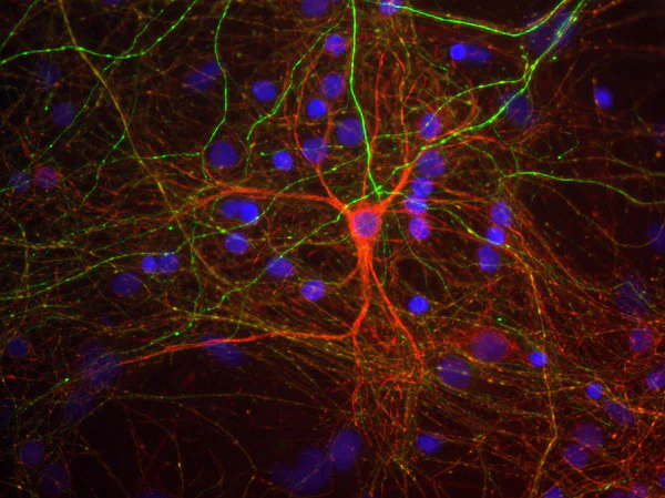 Immunocytochemistry/ Immunofluorescence - Anti-68kDa Neurofilament/NF-L antibody (AB134460)
