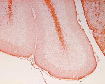Immunohistochemistry (PFA perfusion fixed frozen sections) - Anti-68kDa Neurofilament/NF-L antibody (AB134460)