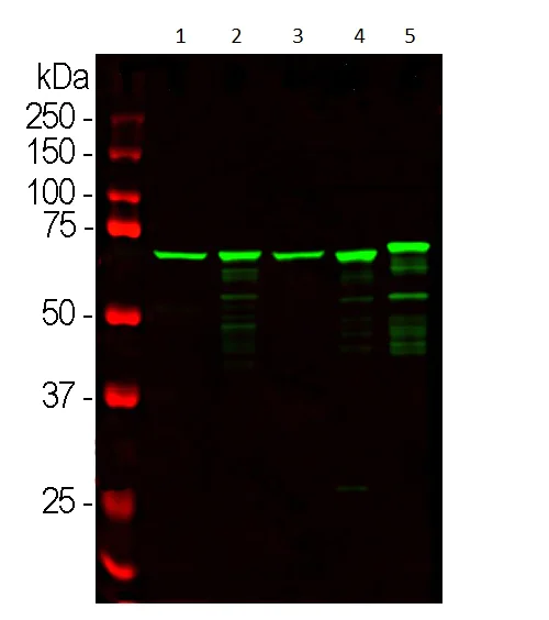 Western blot - Anti-68kDa Neurofilament/NF-L antibody (AB24520)