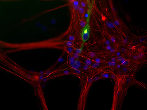 Immunocytochemistry/ Immunofluorescence - Anti-68kDa Neurofilament/NF-L antibody (AB9035)