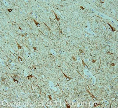Immunohistochemistry (Formalin/PFA-fixed paraffin-embedded sections) - Anti-68kDa Neurofilament/NF-L antibody [DA2] (AB7255)