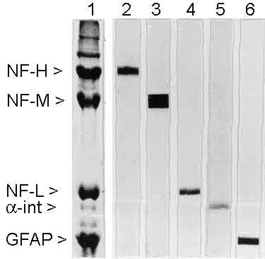 Western blot - Anti-68kDa Neurofilament/NF-L antibody [DA2] (AB7255)