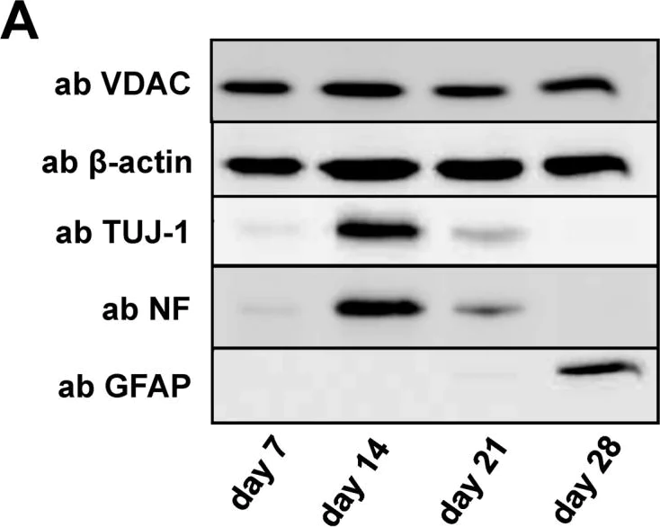 Western blot - Anti-68kDa Neurofilament/NF-L antibody [DA2] (AB7255)