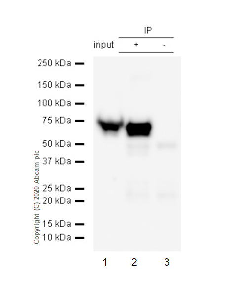 Immunoprecipitation - Anti-68kDa Neurofilament/NF-L antibody [EP675Y] (AB52989)