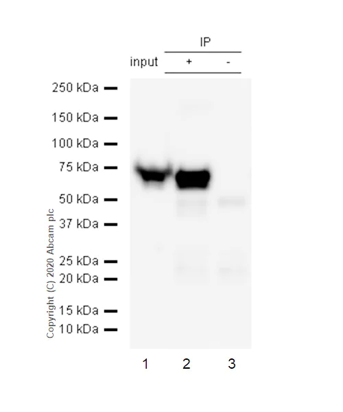 Immunoprecipitation - Anti-68kDa Neurofilament/NF-L antibody [EP675Y] (AB52989)