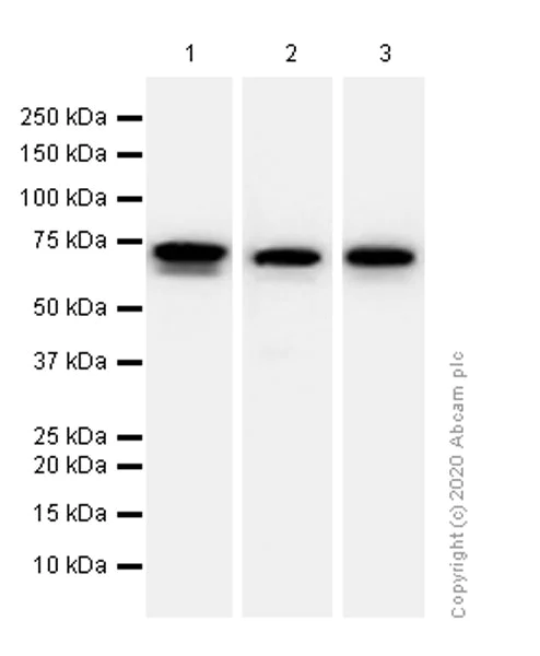 Western blot - Anti-68kDa Neurofilament/NF-L antibody [EP675Y] - BSA and Azide free (AB236122)