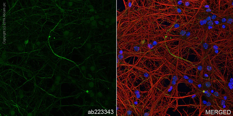 Immunocytochemistry/ Immunofluorescence - Anti-68kDa Neurofilament/NF-L antibody [EPR22035-112] (AB223343)