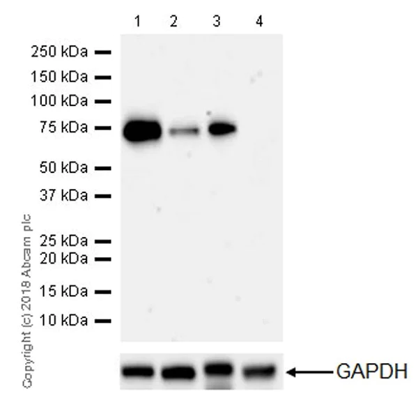 Western blot - Anti-68kDa Neurofilament/NF-L antibody [EPR22035-112] (AB223343)