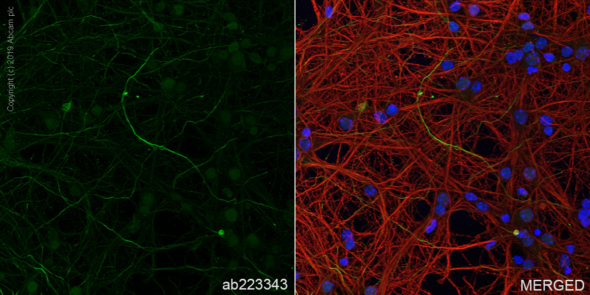 Immunocytochemistry/ Immunofluorescence - Anti-68kDa Neurofilament/NF-L antibody [EPR22035-112] - BSA and Azide free (AB238420), expandable thumbnail