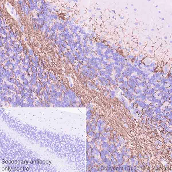 Immunohistochemistry (Formalin/PFA-fixed paraffin-embedded sections) - Anti-68kDa Neurofilament/NF-L antibody [EPR22035-112] - BSA and Azide free (AB238420)