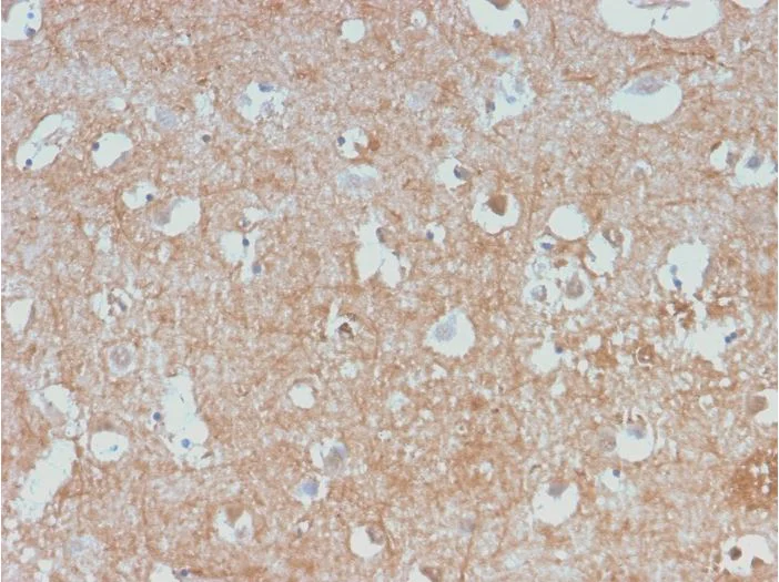 Immunohistochemistry (Formalin/PFA-fixed paraffin-embedded sections) - Anti-68kDa Neurofilament/NF-L antibody [NEFL/2983R] (AB270266)