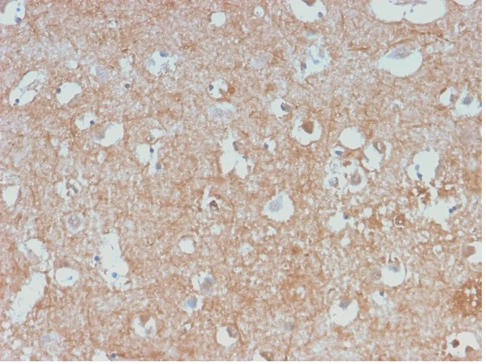 Immunohistochemistry (Formalin/PFA-fixed paraffin-embedded sections) - Anti-68kDa Neurofilament/NF-L antibody [NEFL/2983R] - BSA and Azide free (AB270297)