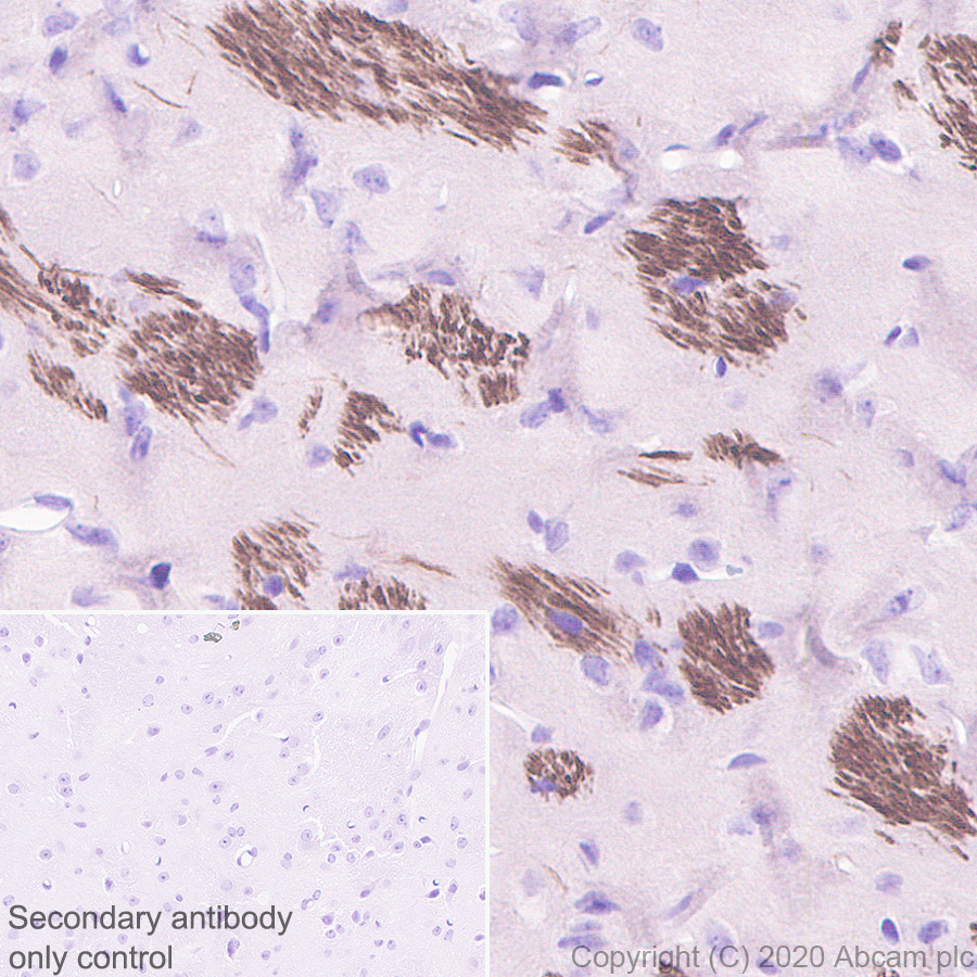 Immunohistochemistry (Formalin/PFA-fixed paraffin-embedded sections) - Anti-68kDa Neurofilament/NF-L antibody [Nfl21] (AB273441), expandable thumbnail
