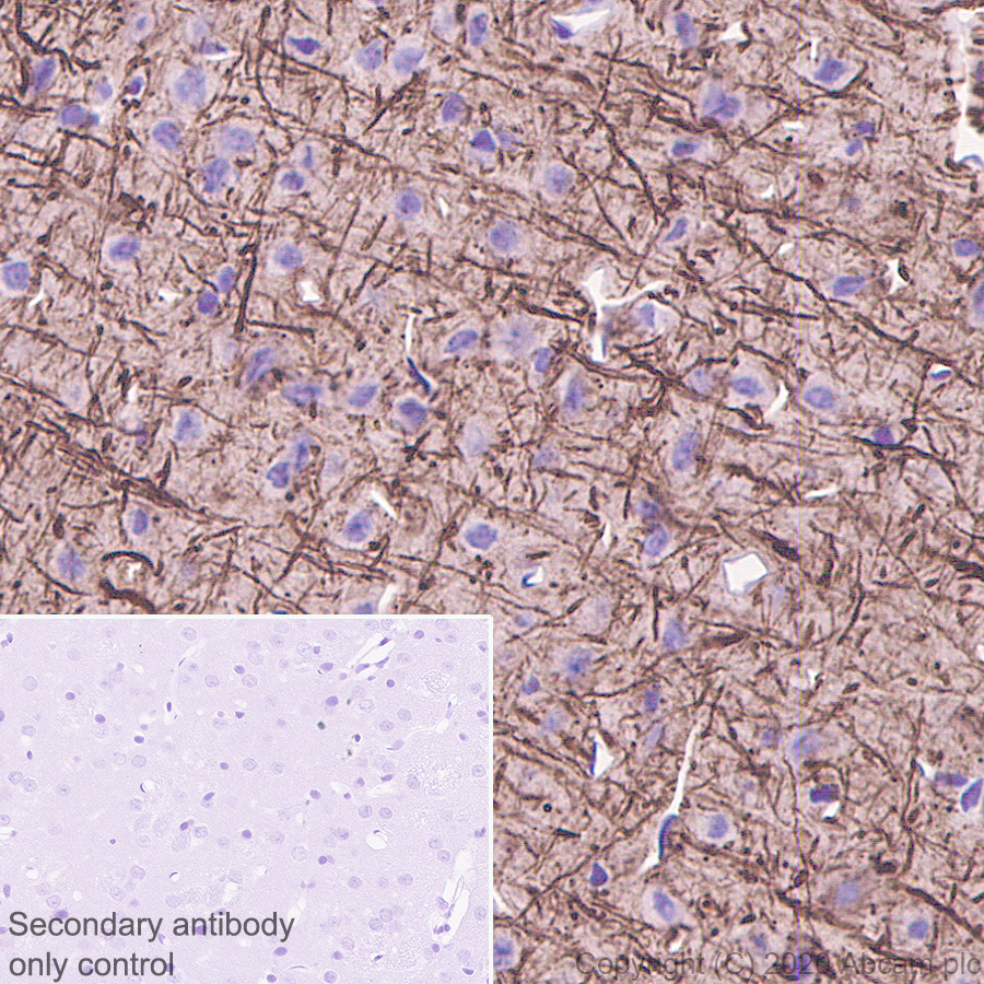 Immunohistochemistry (Formalin/PFA-fixed paraffin-embedded sections) - Anti-68kDa Neurofilament/NF-L antibody [Nfl21] (AB273441), expandable thumbnail